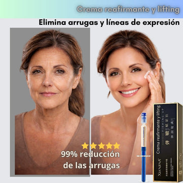 Crema reafirmante y lifting: elimina arrugas